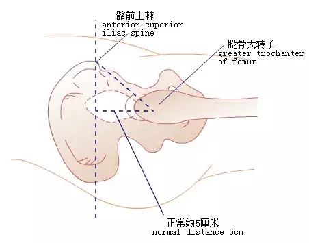 骨科查体从初级到骨灰级你都得知道